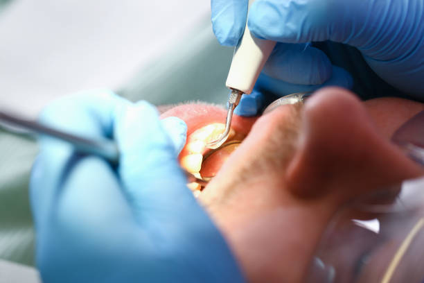 Best Emergency Dental Care for Broken or Chipped Teeth in Stamps, AR