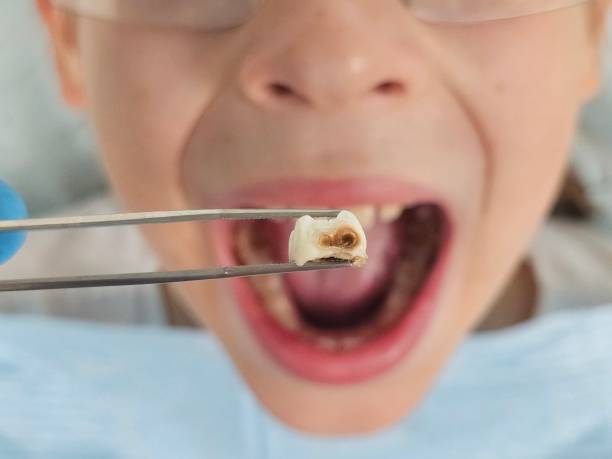 Best Emergency Treatment for Dental Infections or Abscesses in Stamps, AR