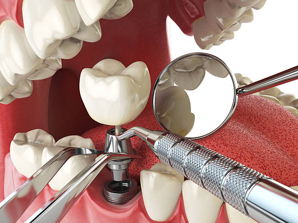 Best Urgent Care for Lost Fillings or Crowns in Stamps, AR